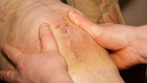 knee